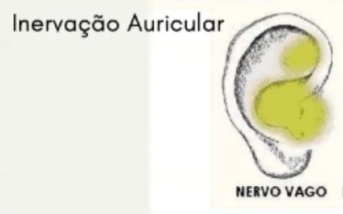 Acesso do nervo vago na orelha