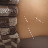 Acupuntura e Dor Crônica: Em Quais Casos Ela é Mais Eficaz?
