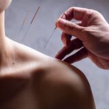 Acupuntura em dor crônica quando os resultados são mais lentos