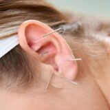 Acupuntura na Medicina Moderna Reconhecimento Científico e Tratamento da Dor