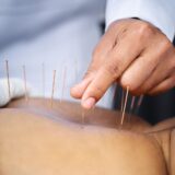 Como motivar pacientes que já tiveram más experiências com a acupuntura