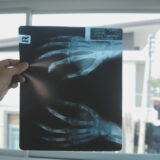 Descarte correto de materiais de exames