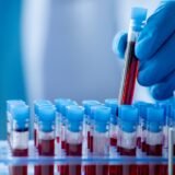 Existe exame de sangue que diagnostica endometriose?