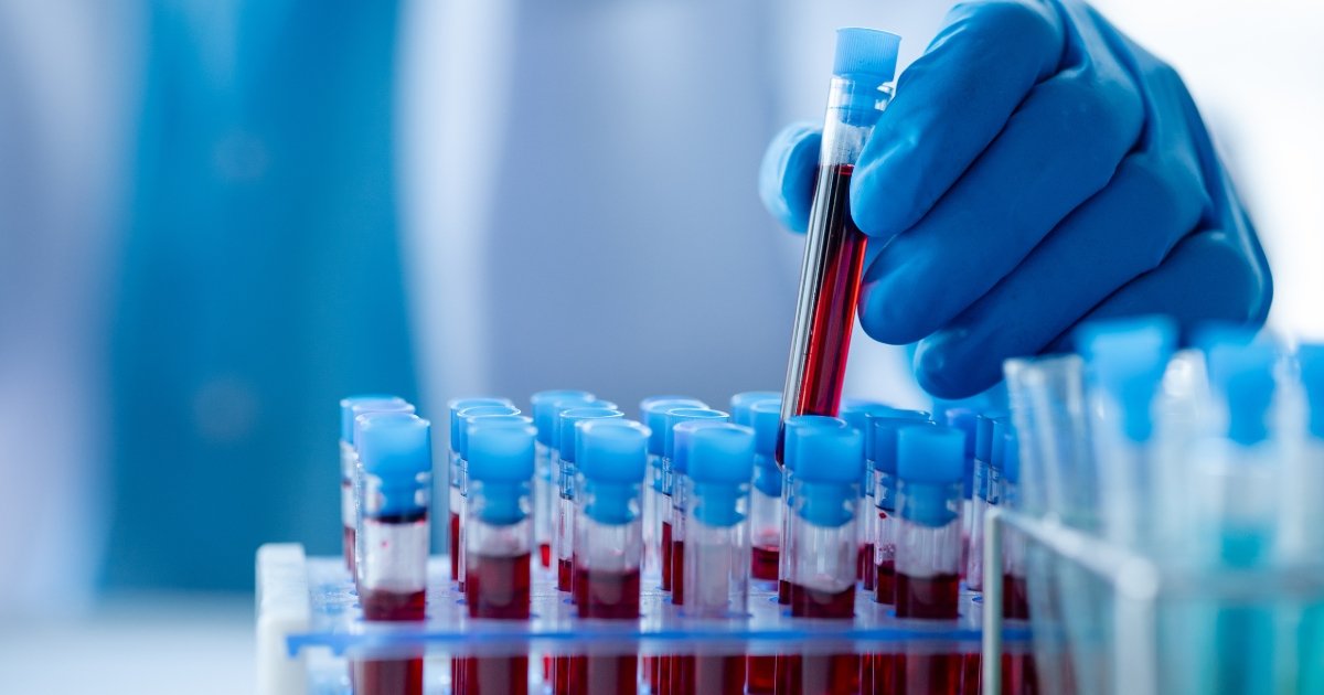 Existe-exame-de-sangue-que-diagnostica-endometriose.jpg